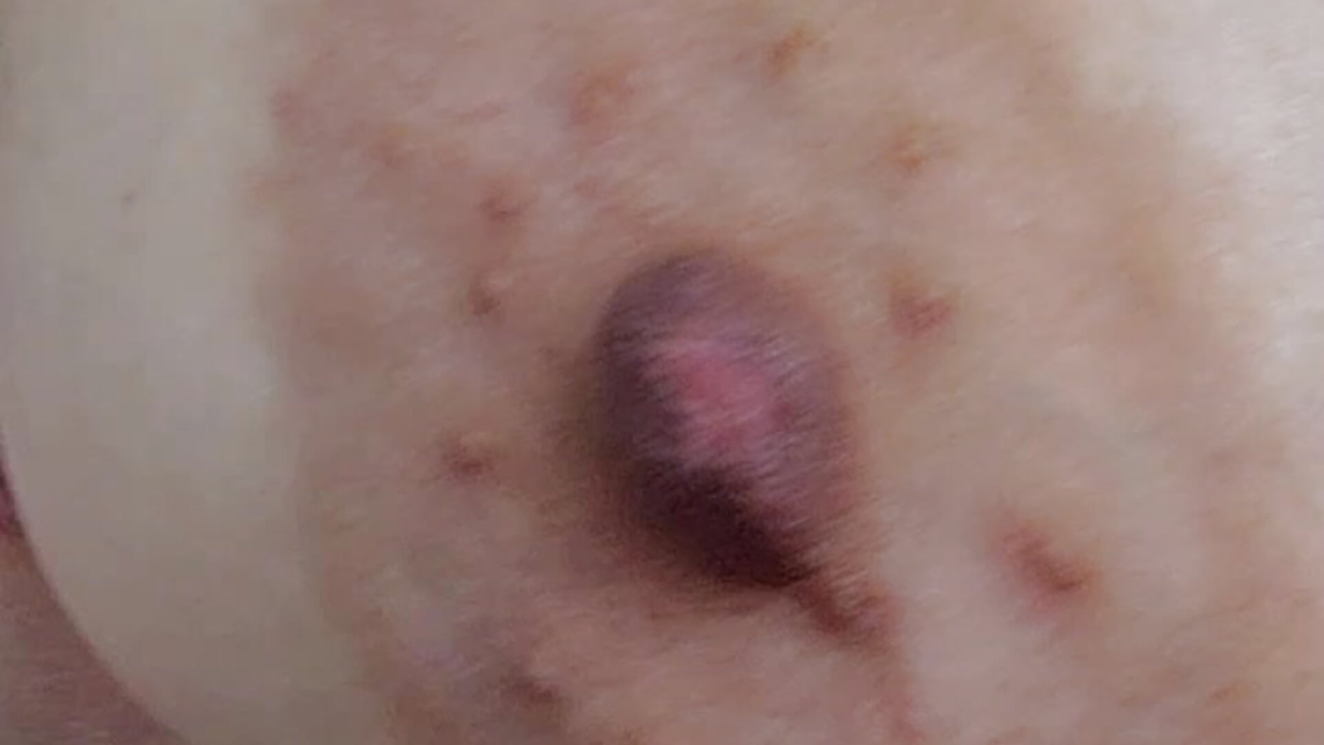 Close up of my big boobs🍒🍒🤭🤭