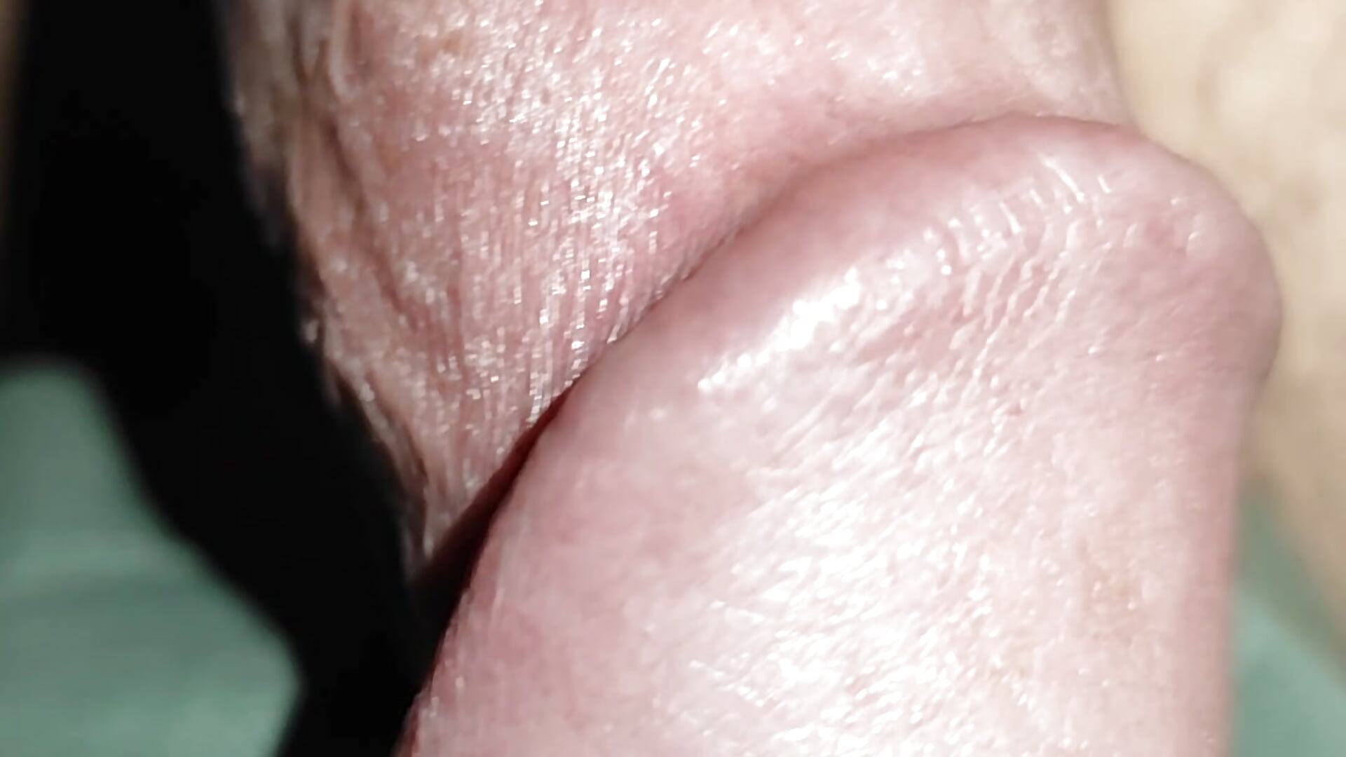 1000031294