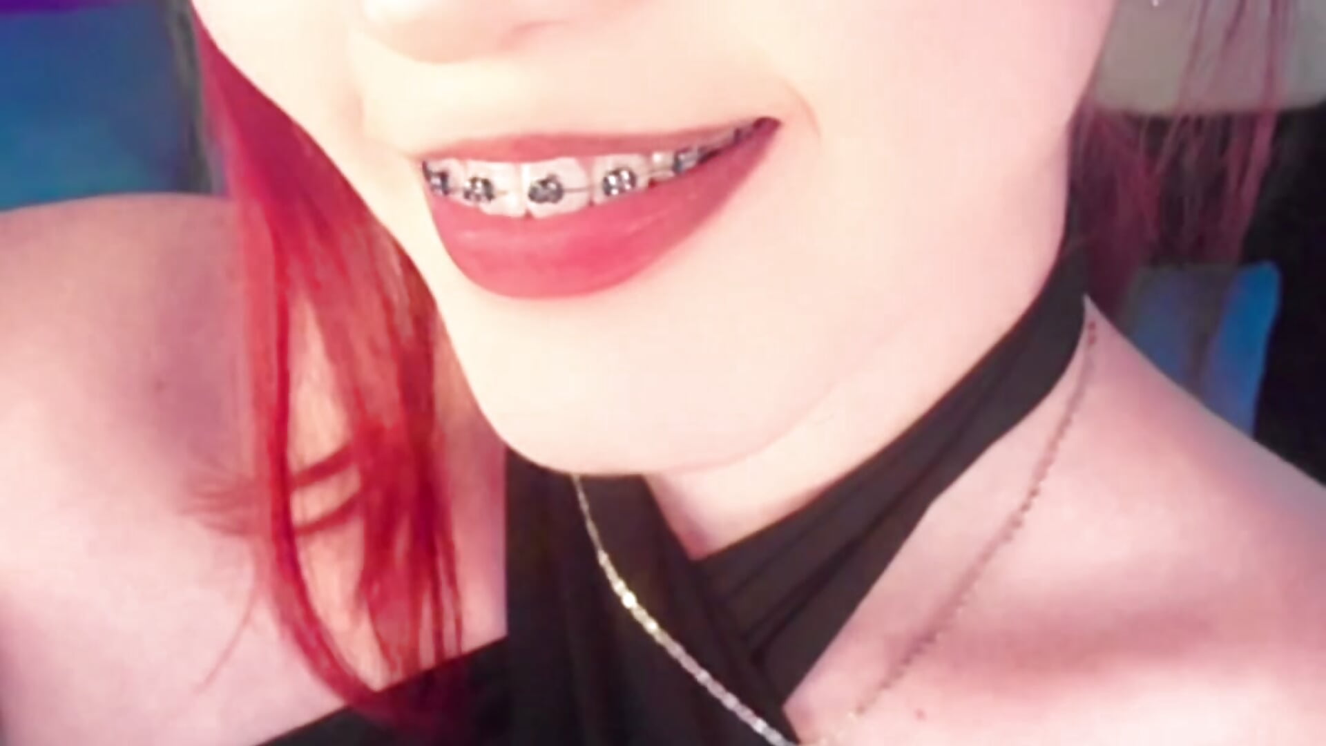 braces hehehe - video by RosesLizzyy cam model