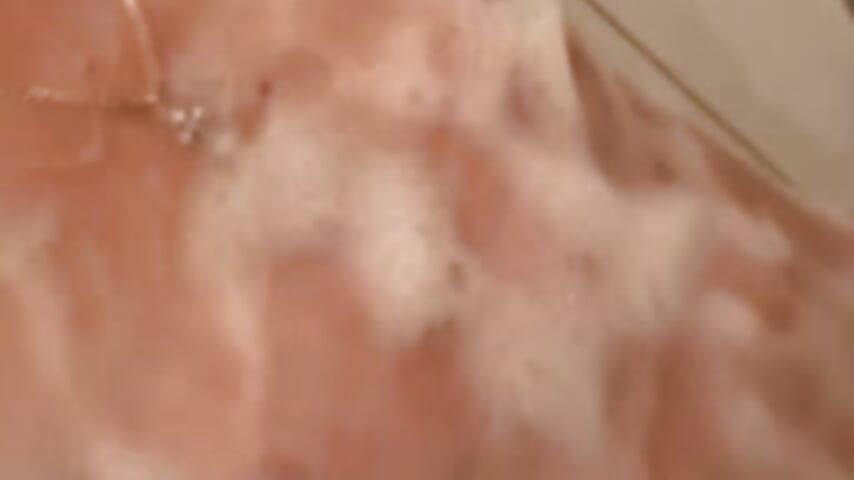 Papillae in foam - video by FireWater6 cam model