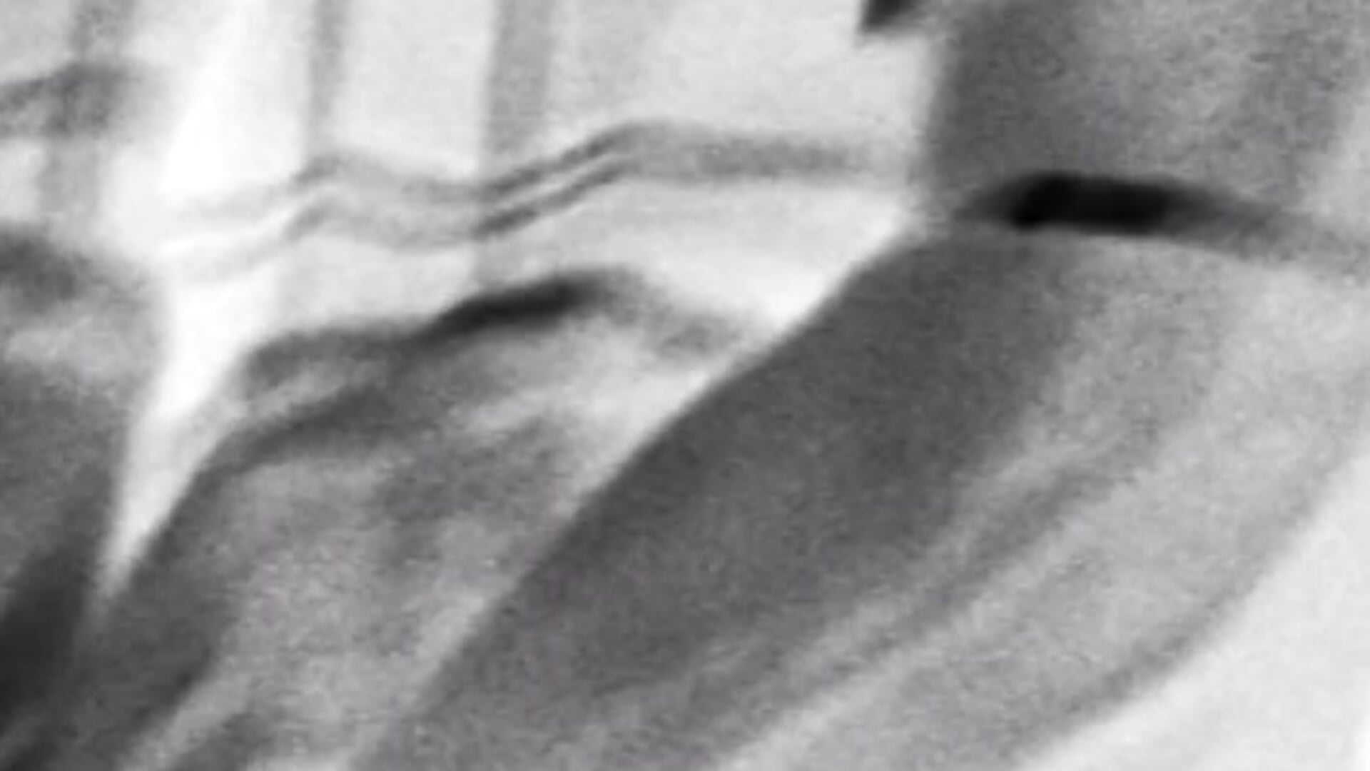 lv_7388587027651988791_20260301235206 – video af Pinkladyvip cam-model