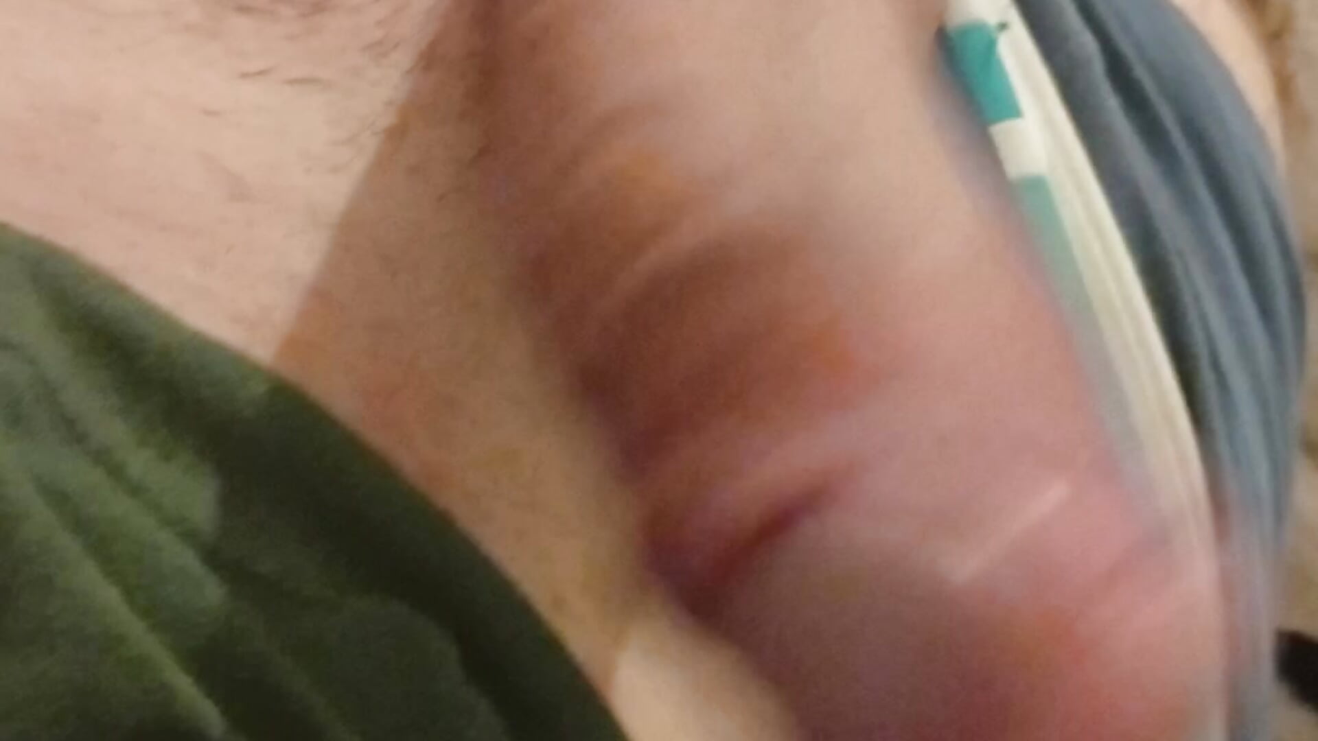 CarvingLeprosy - video di tendenza della modella di cam 3441