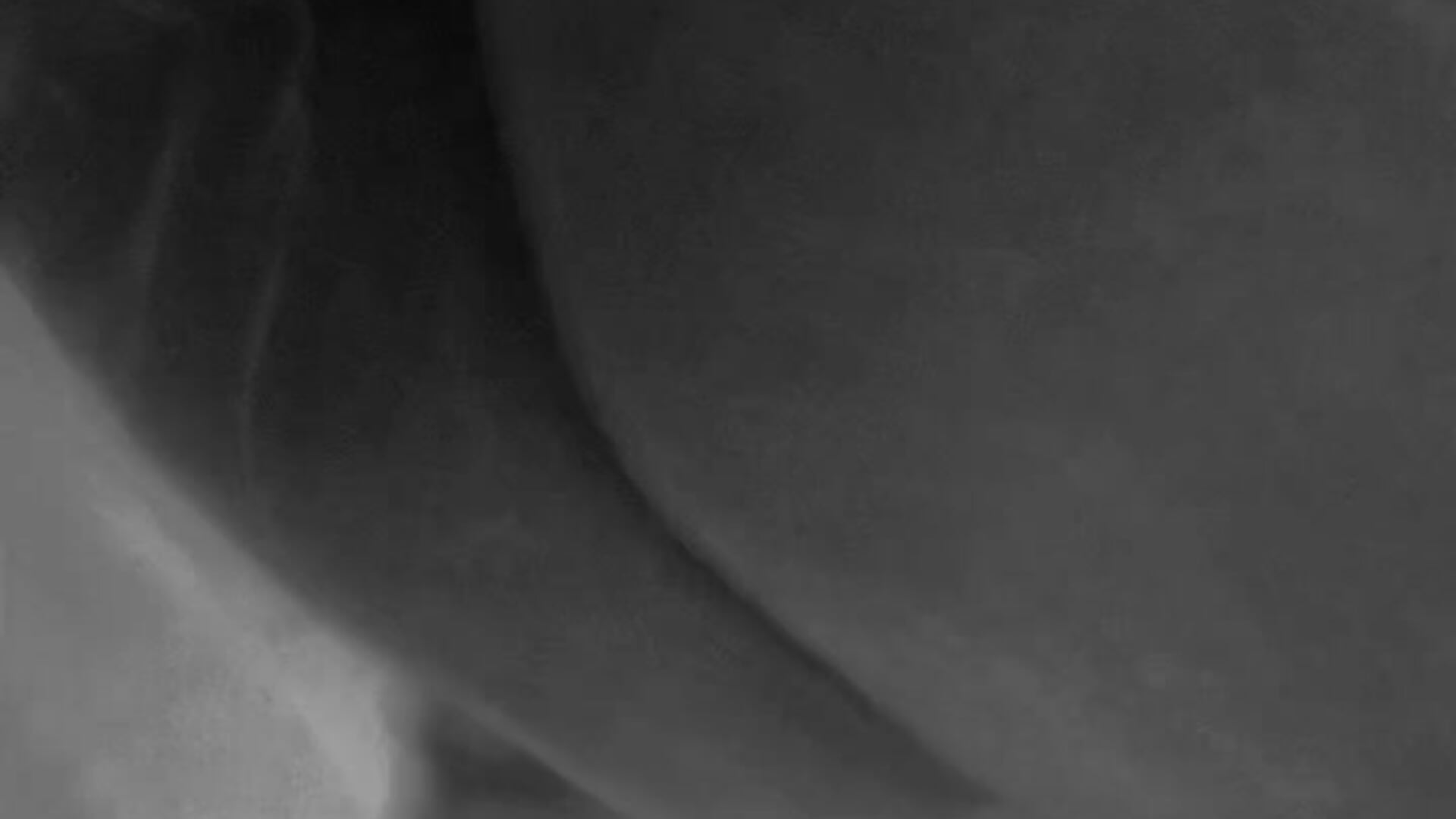 🍑 - clip cu Lizz777 model videochat