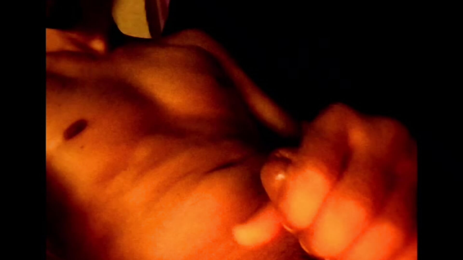 1000097281