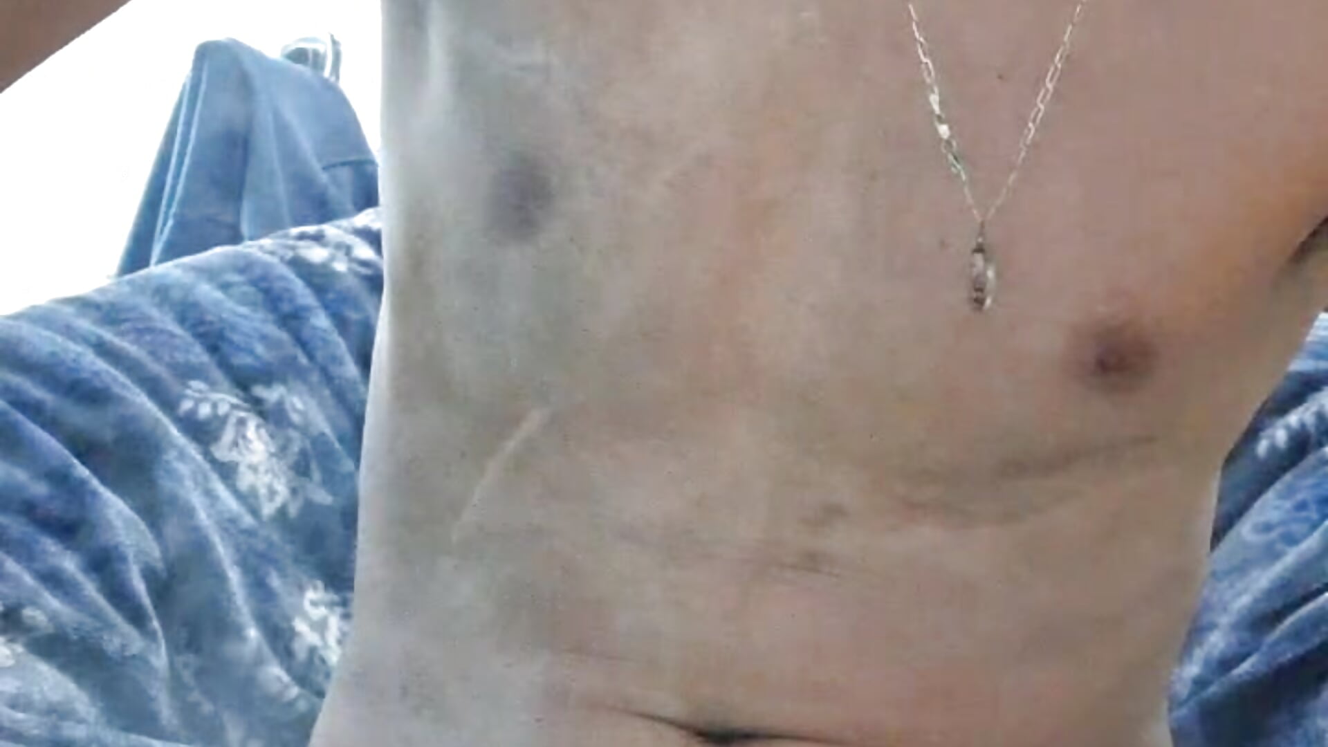 Mesobaslamacana