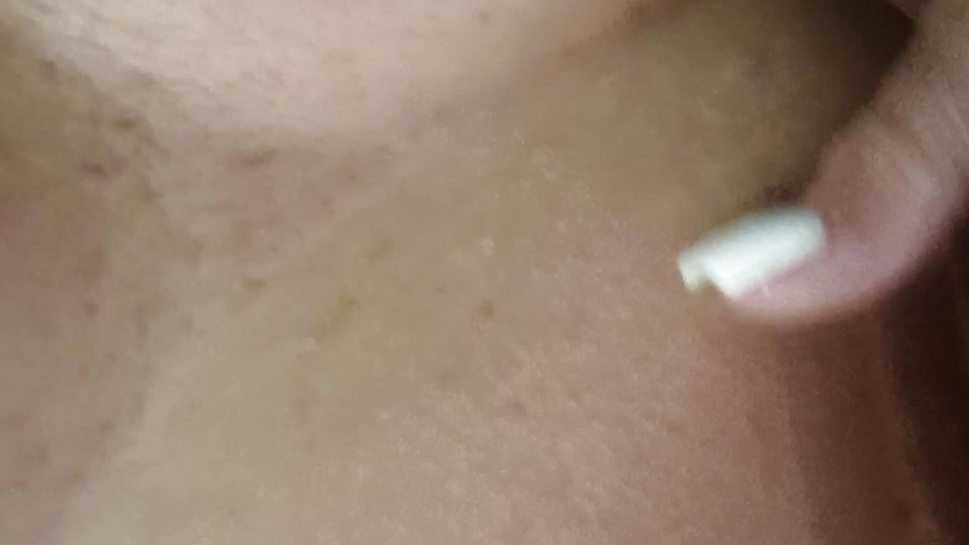 Tease
