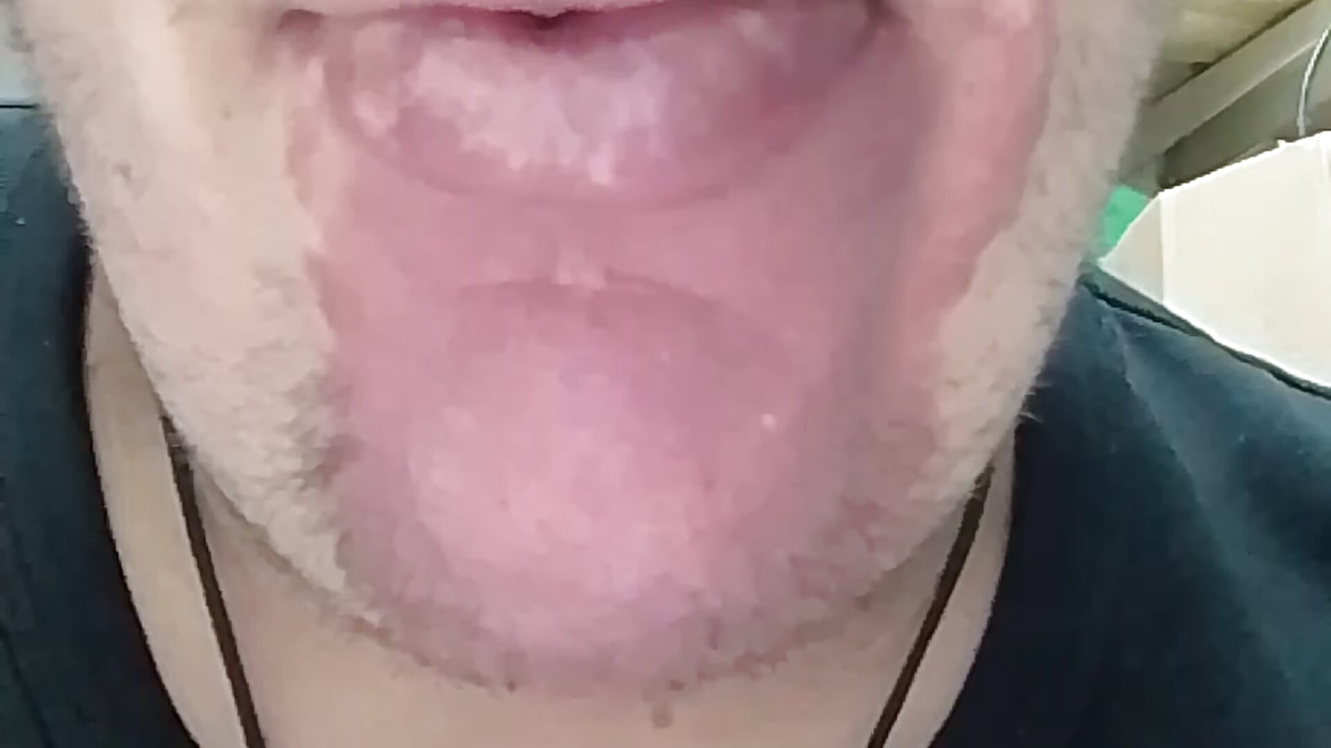 1000048323