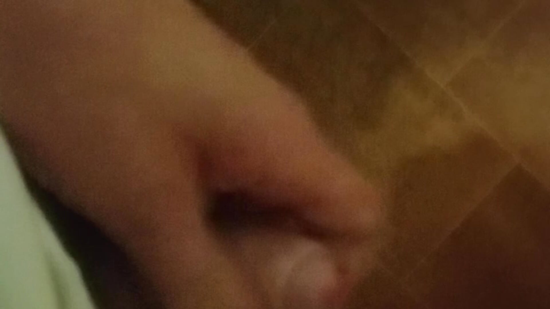 5772