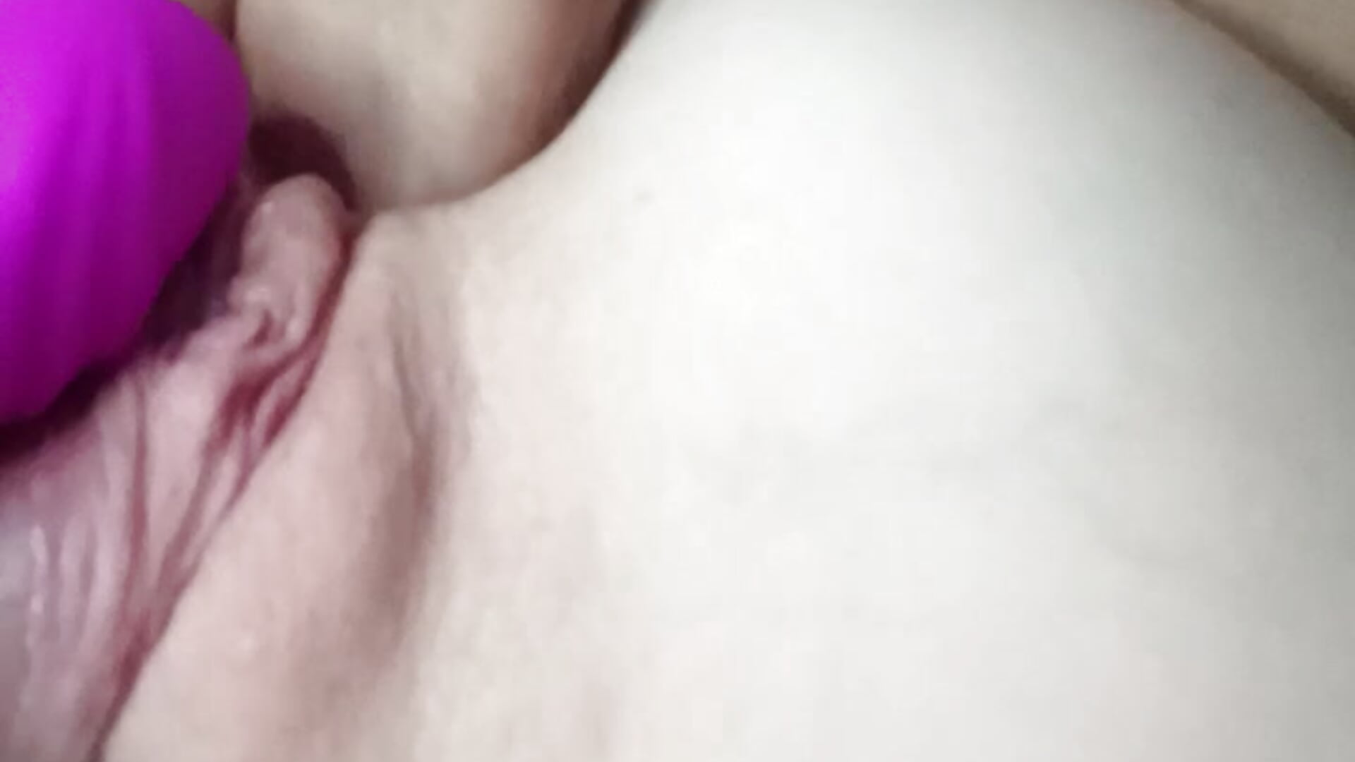 Anal