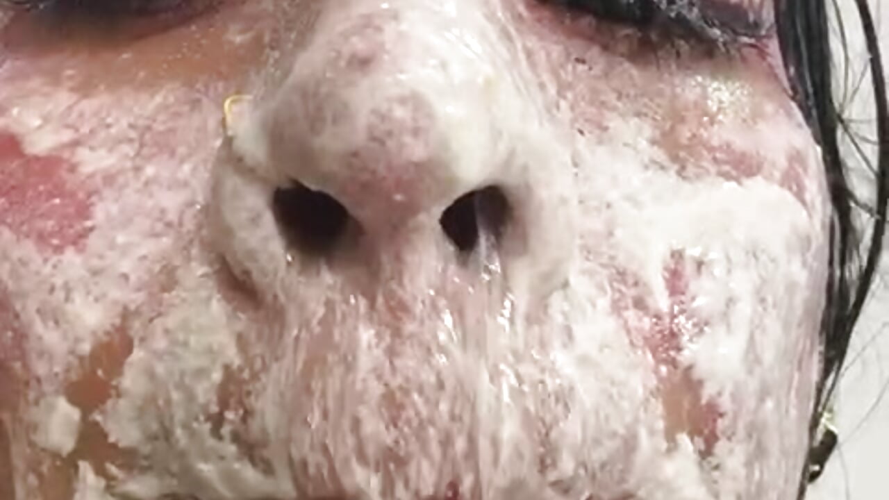 Destroyed face and snot on the outside