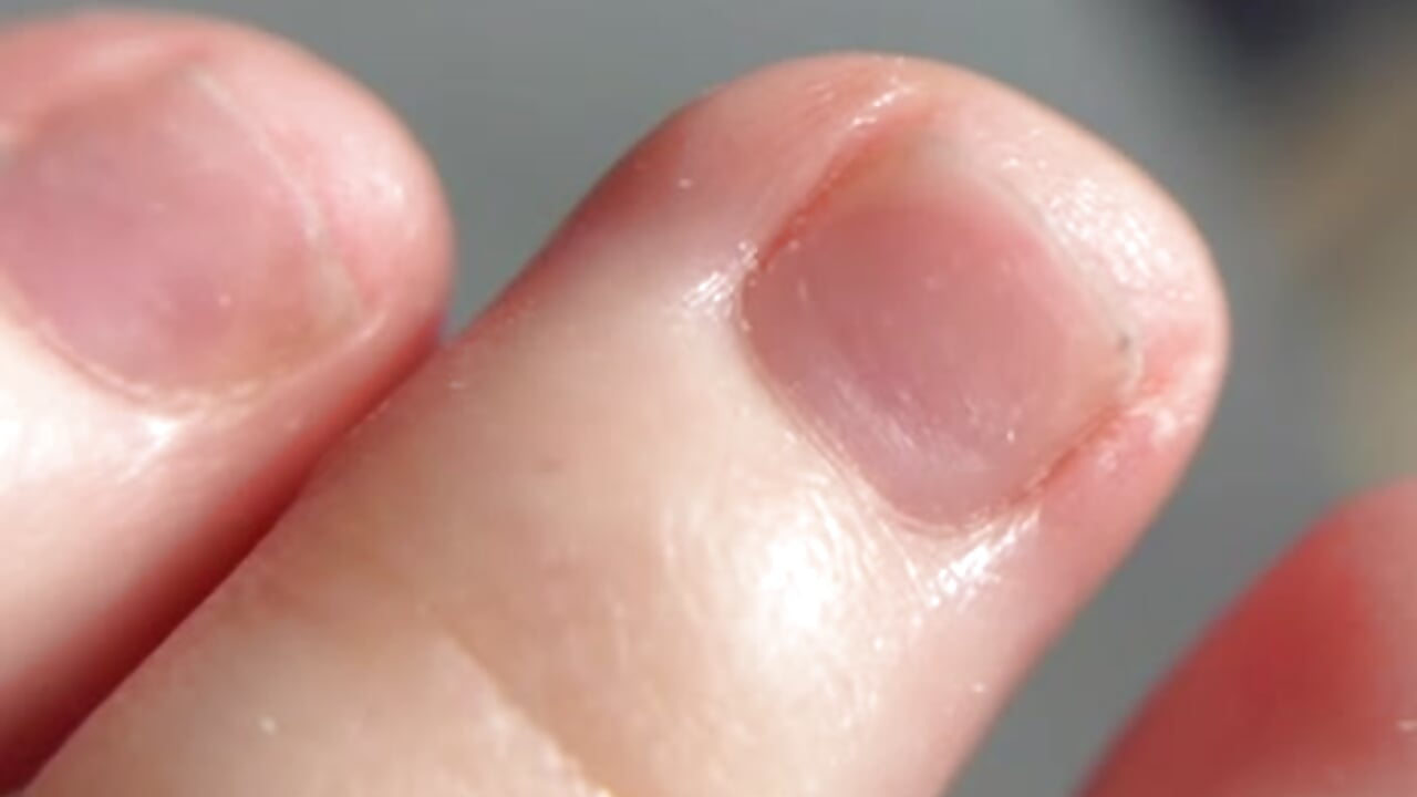 natural toenails – video od webkamerové modelky Miss1Mary1
