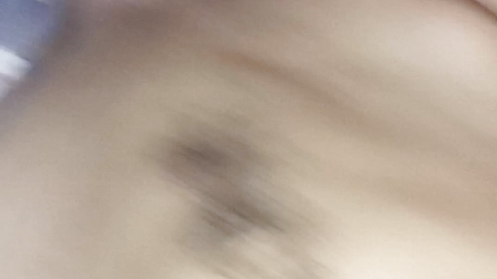 1000028363
