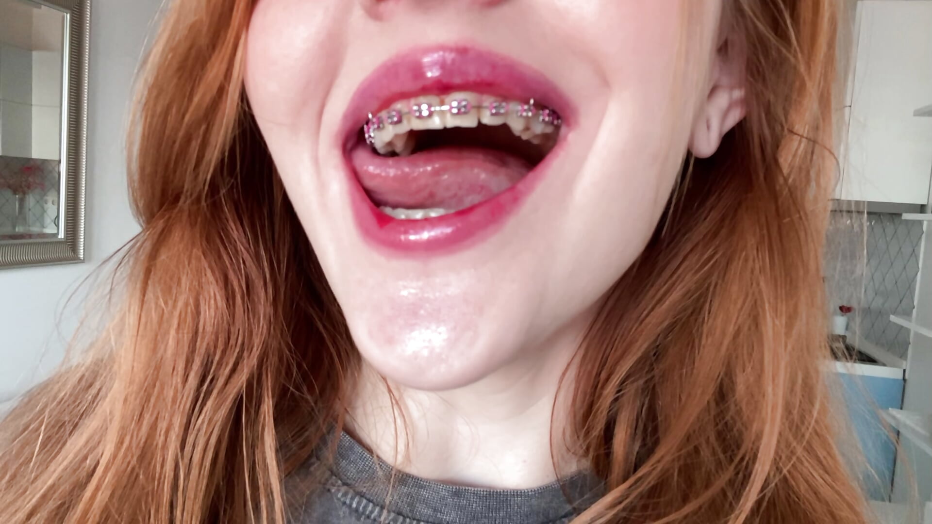 Braces ^^ - video by alunavita_aww cam model