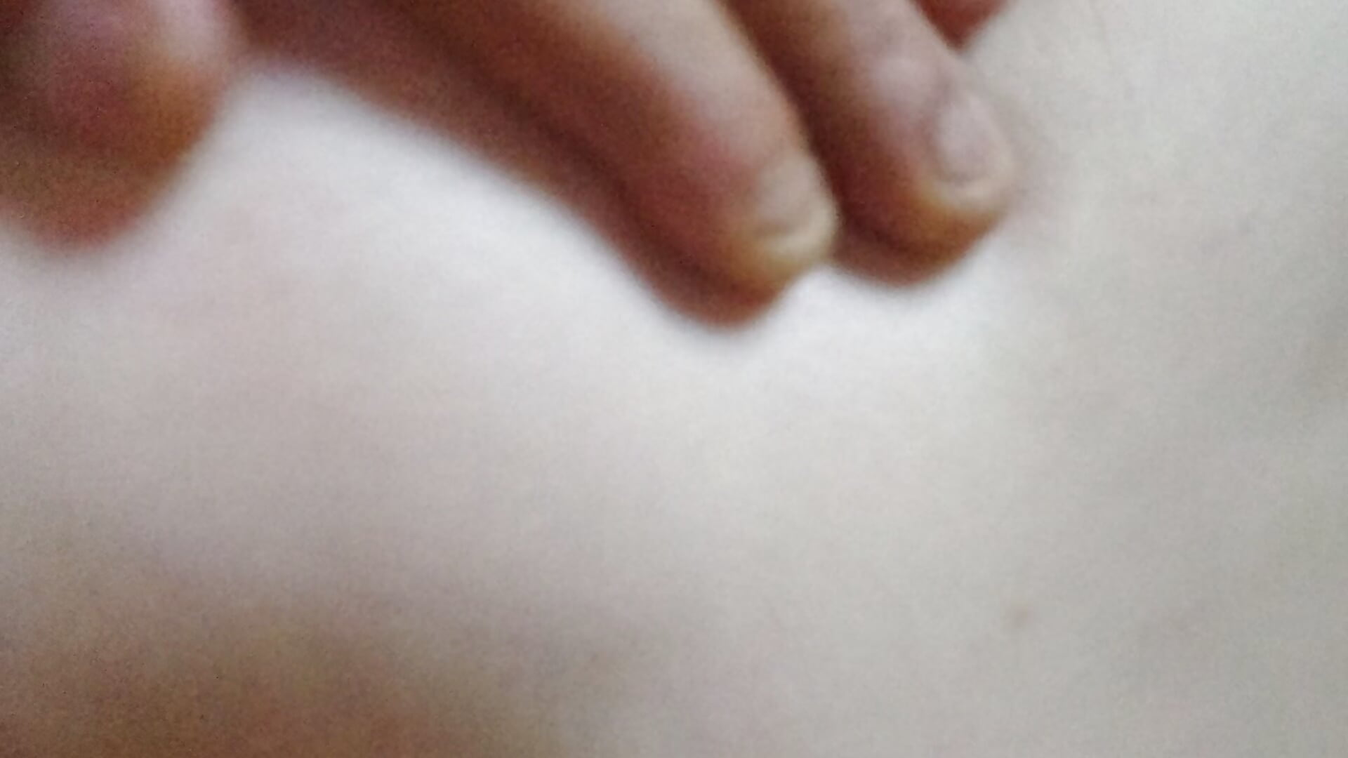1000001657