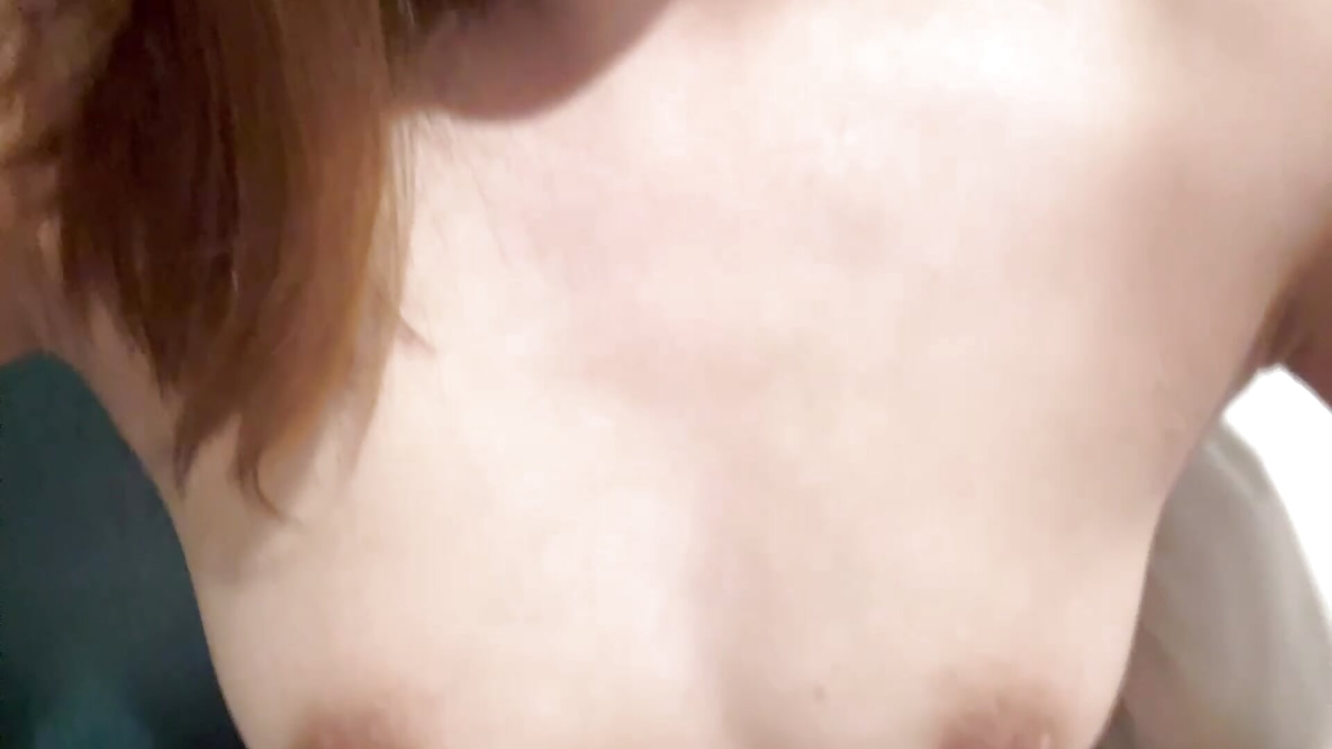 育毛21日目🌱もう結構生えてきたよ~🥺💖