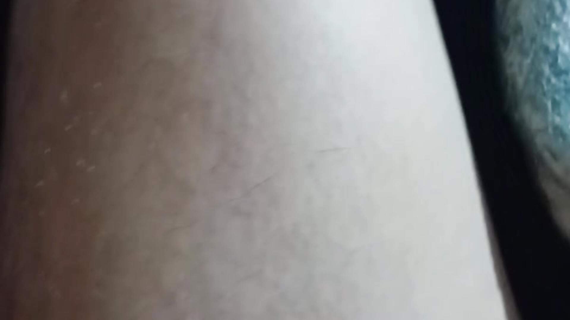 1000475795