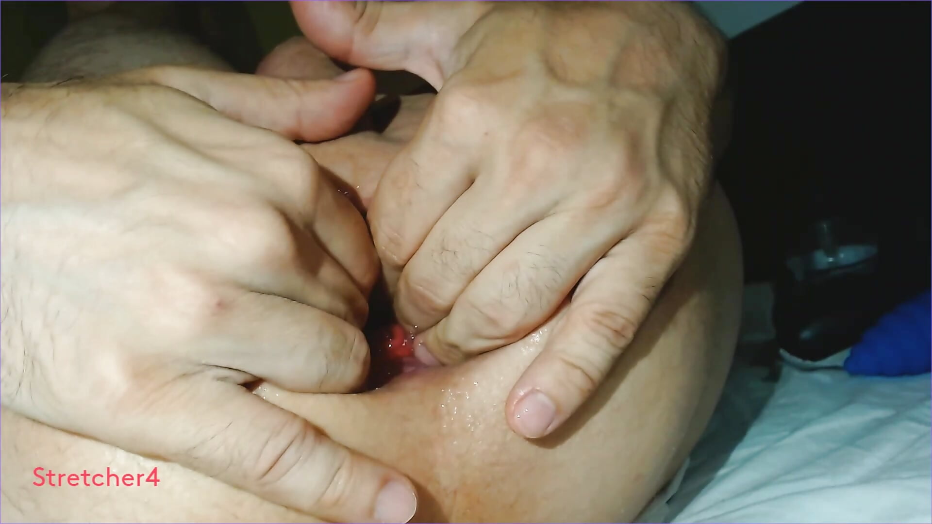 prolapse - video Stretcher4 kameramallilta
