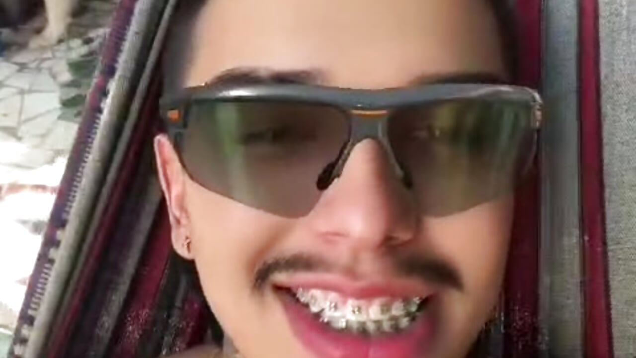 Tyson_brow