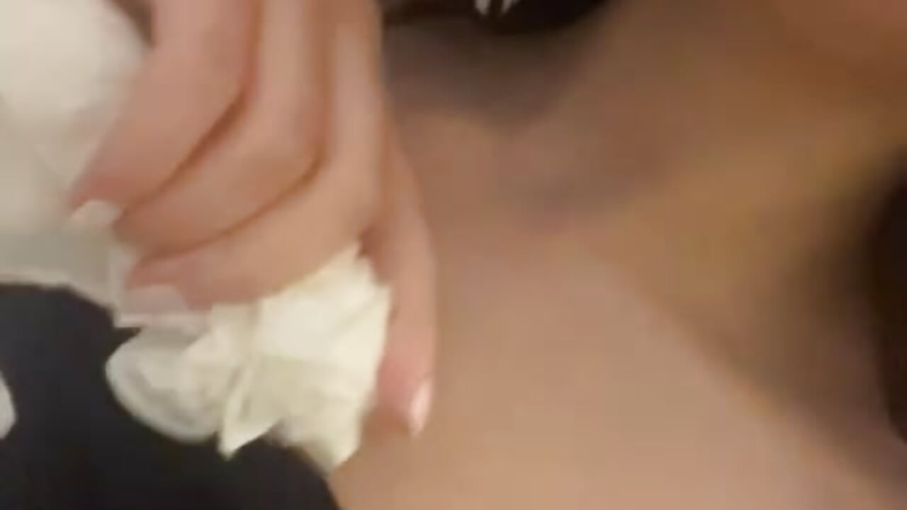 Icecube on nipples