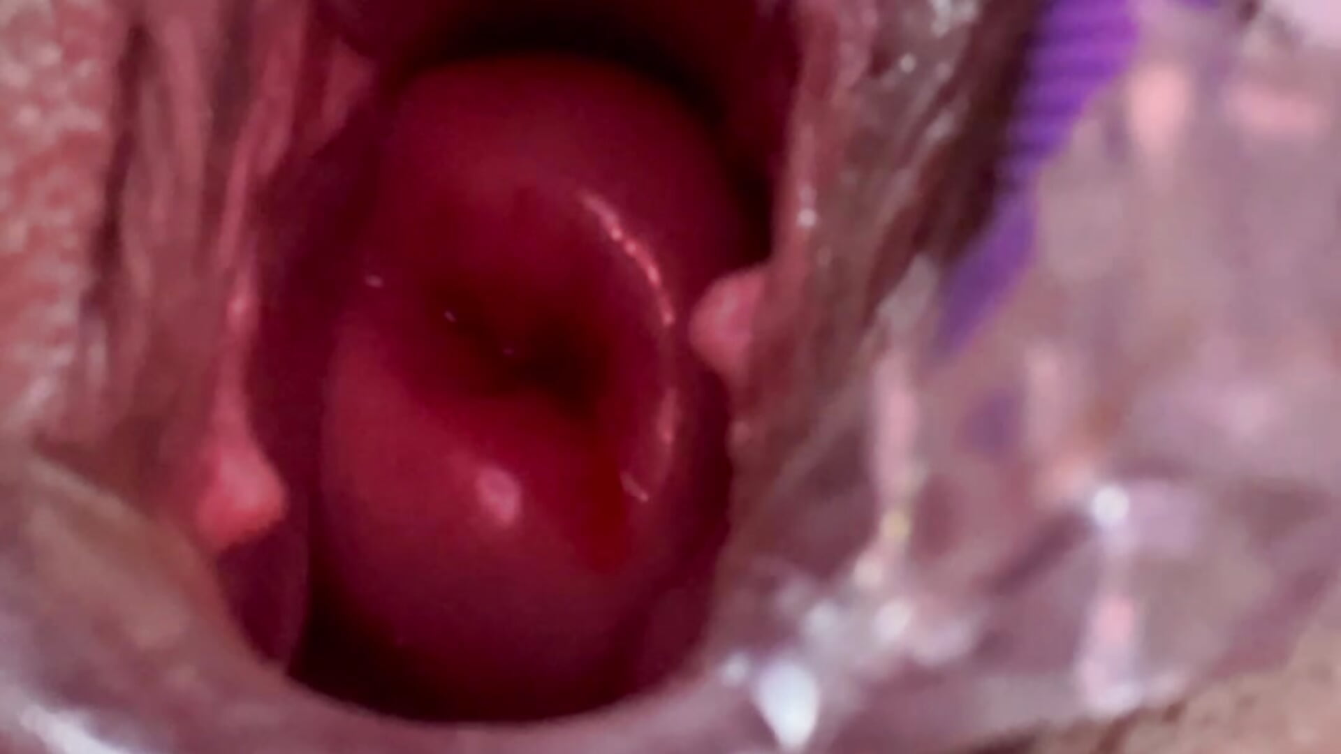 Especulum cervix - video by Dakota_dirty_whore cam model