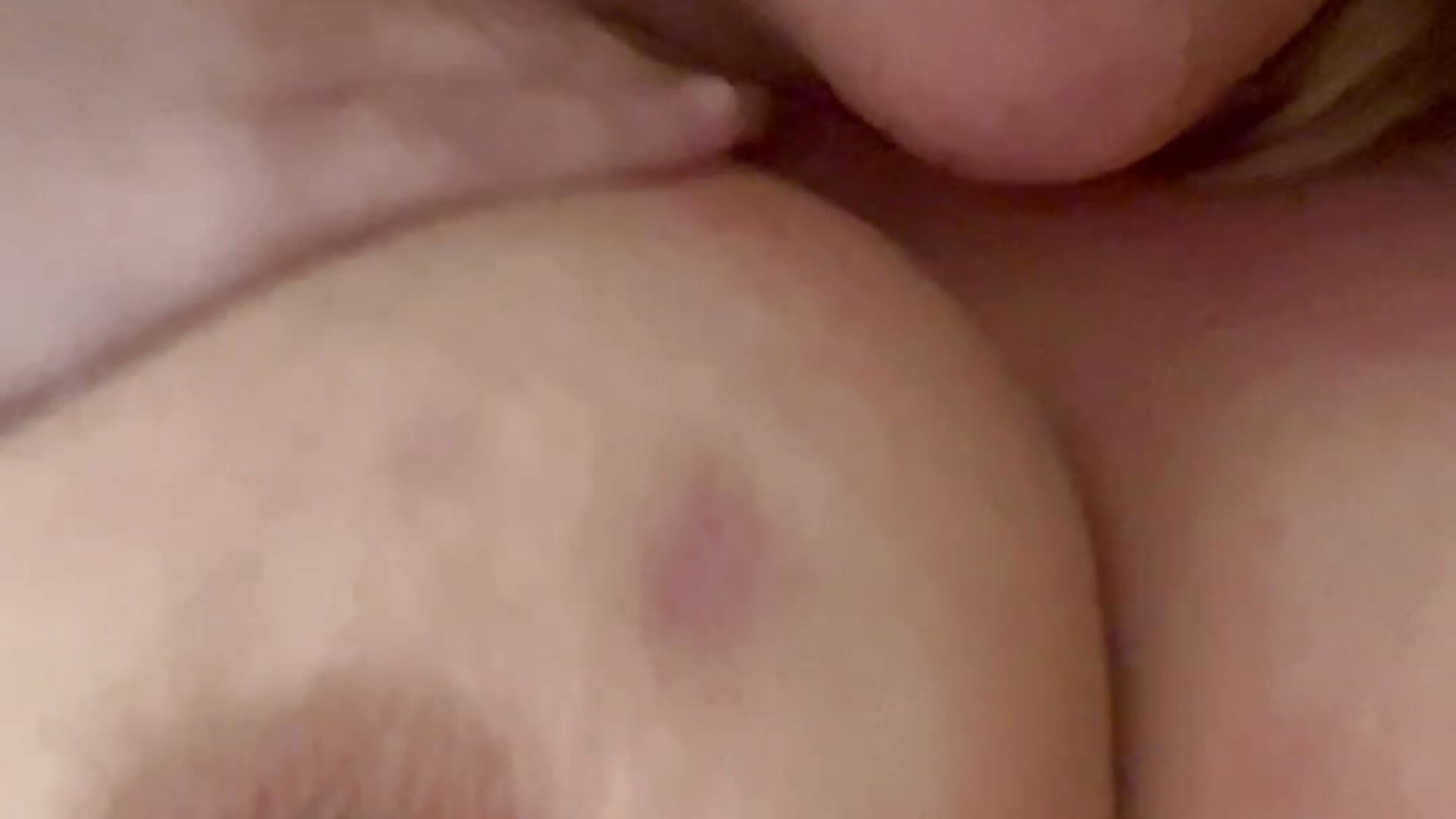 Nipple pinch