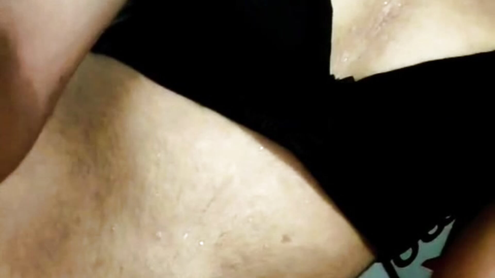 1000255154