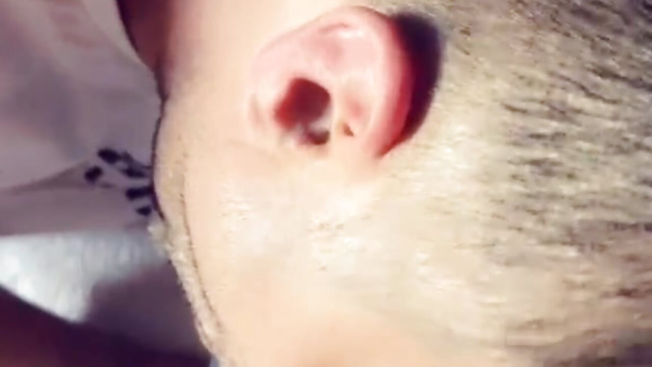 100