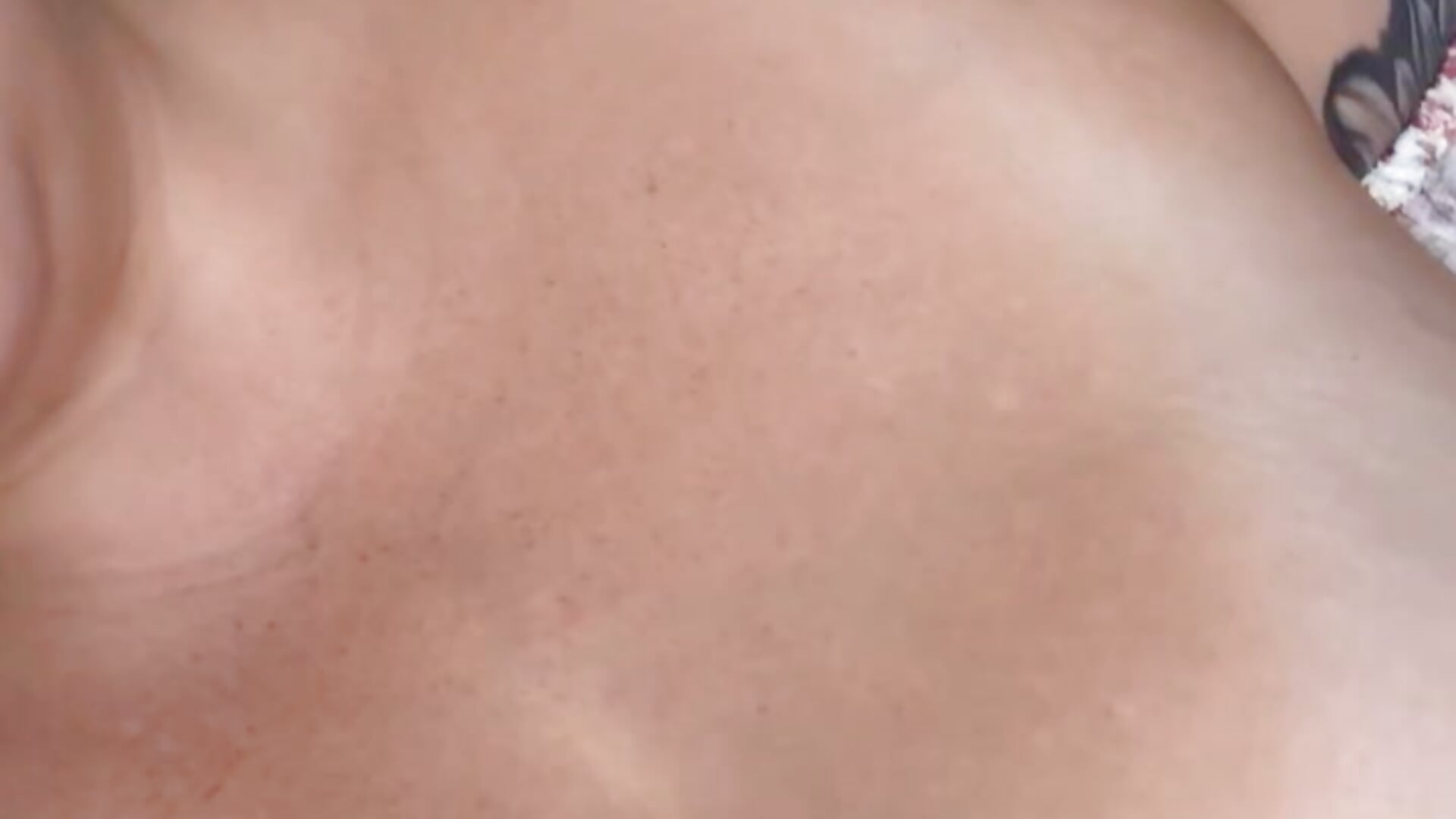 nipple