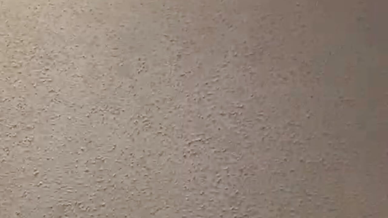 1000049390