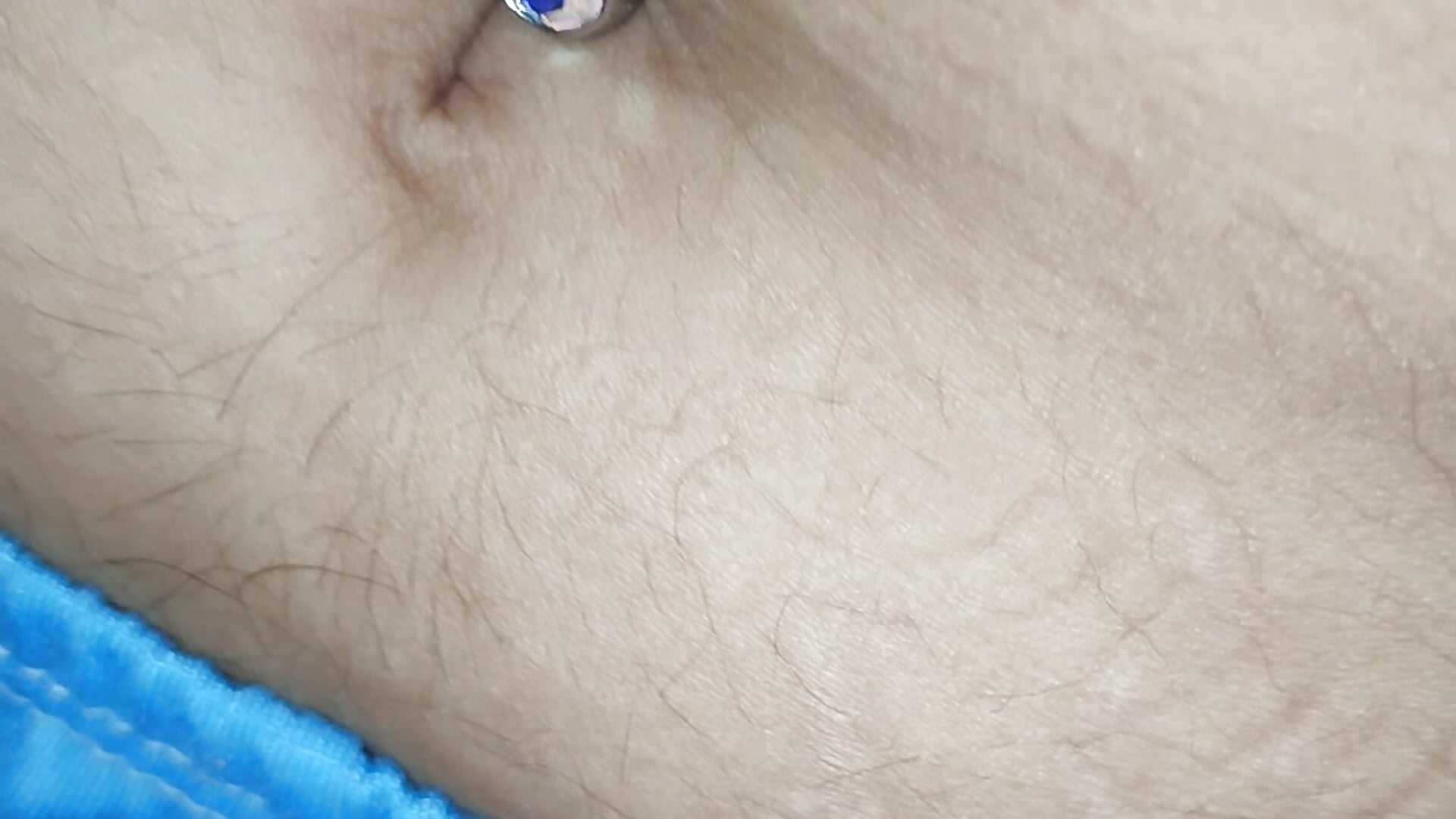 1000040923