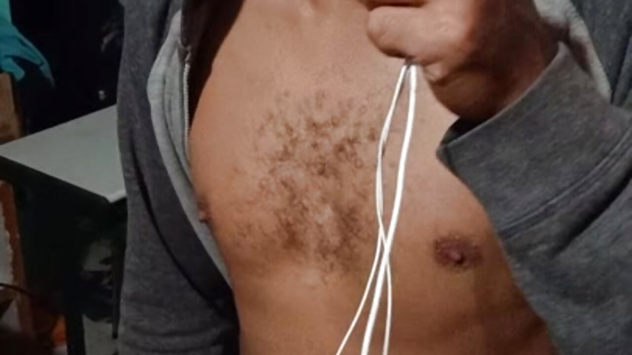 Mascarado ataca novamente 🥵