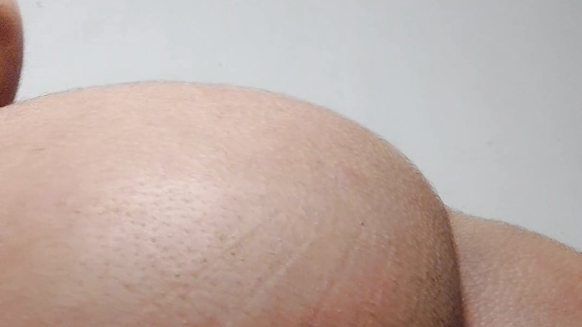 1000006408