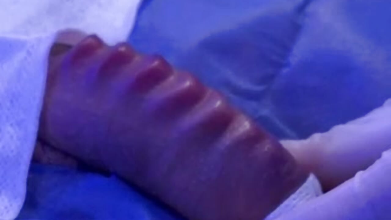 Polla pearling – video od alexander-lacos