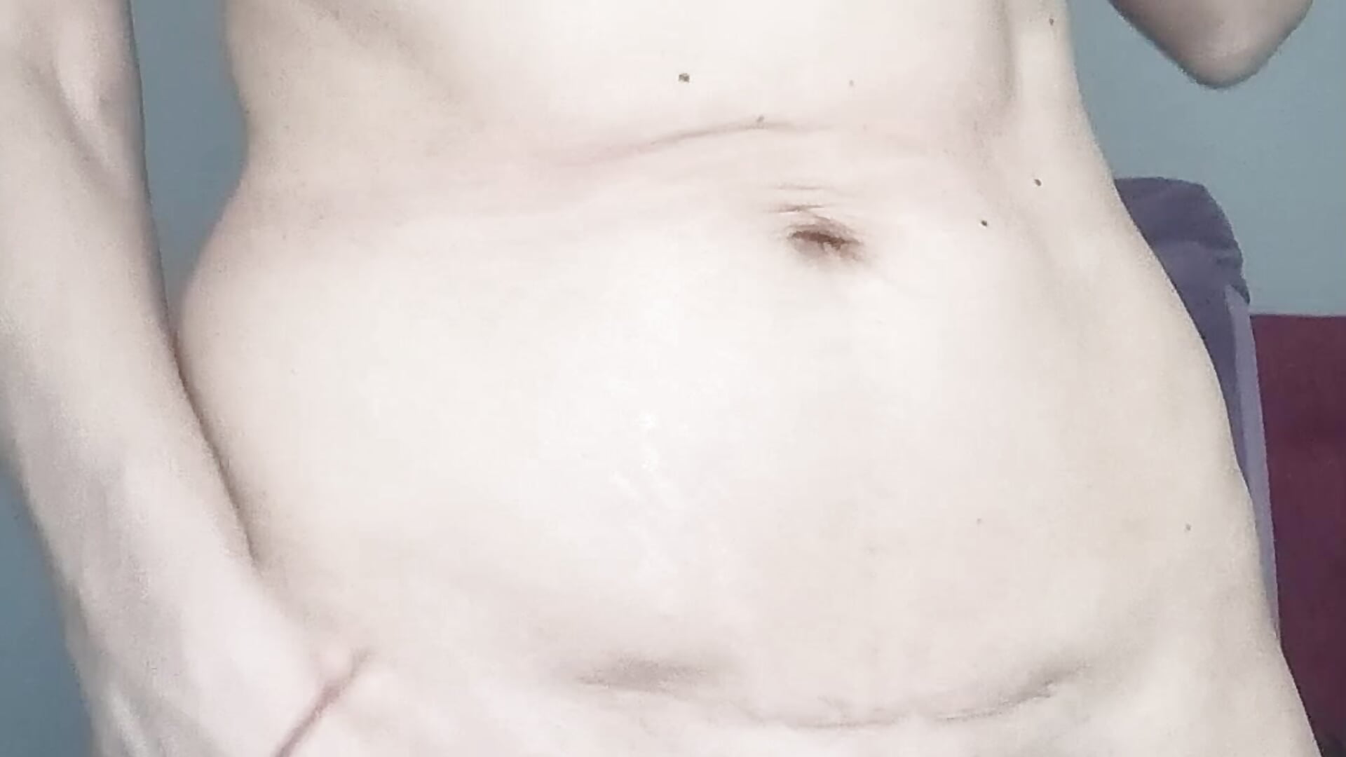 My sexy scare on my tummy. It is my secret place. Can you take my dress of and fuck me? - video by WhiteQueen888 cam model