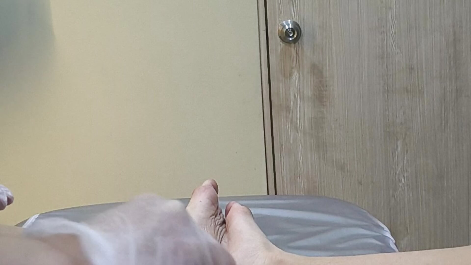 Laser Hair Removal