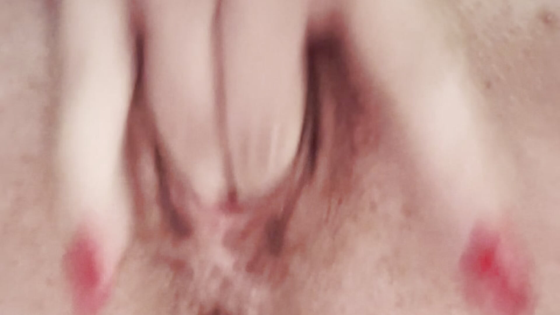 SQUIRT