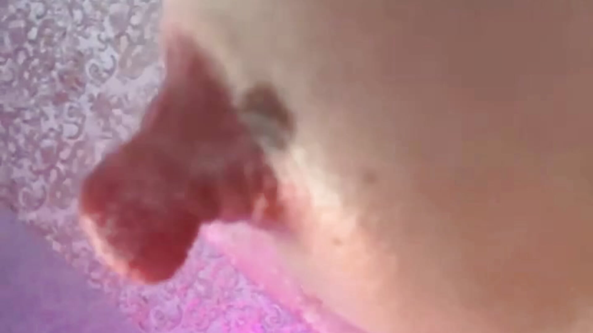 Nipples close to cam