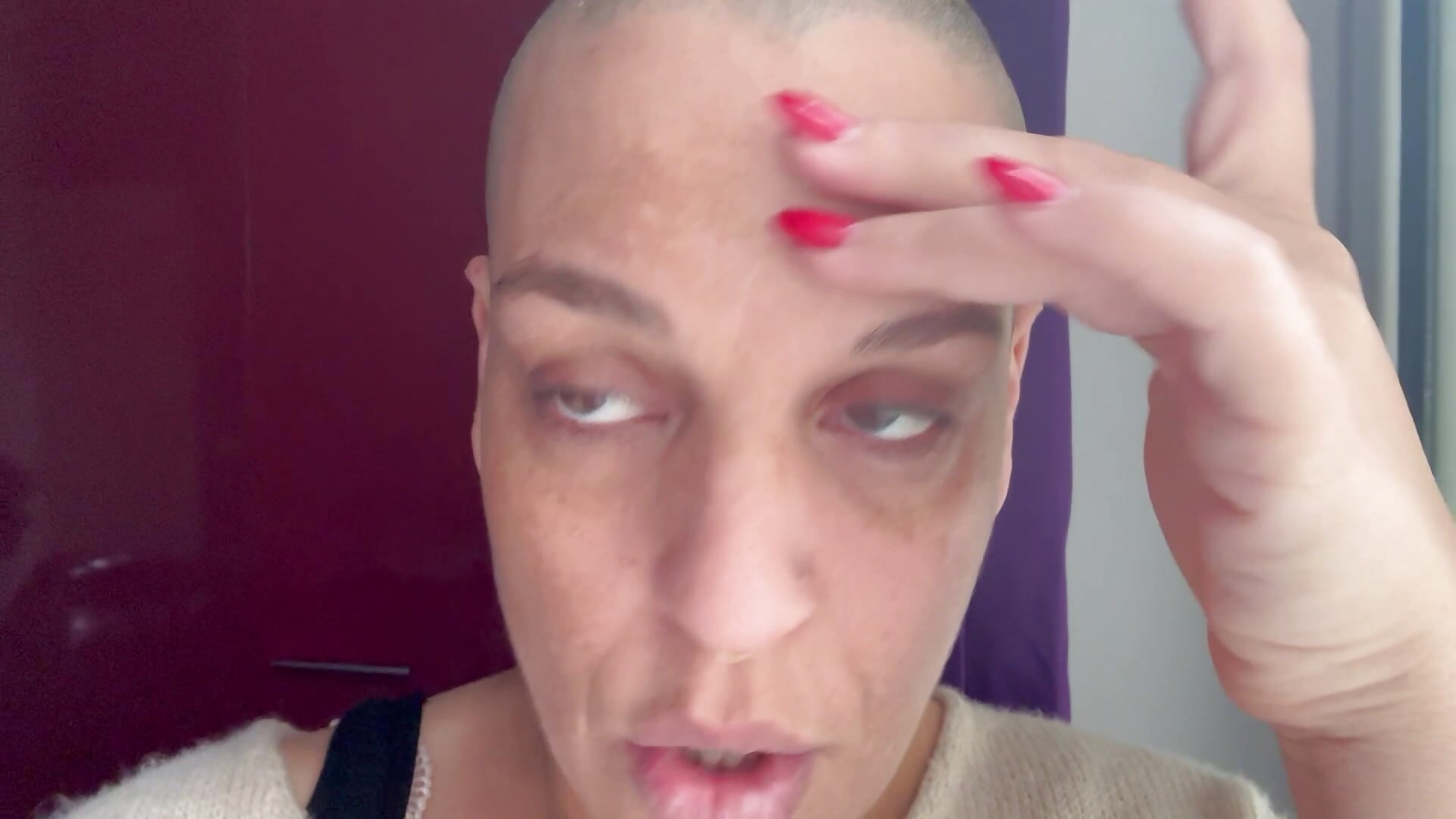 showing & talking about my patches on my face - look at what  pregnancy hormones do to the body! - Video von emprexkala Cam-Model