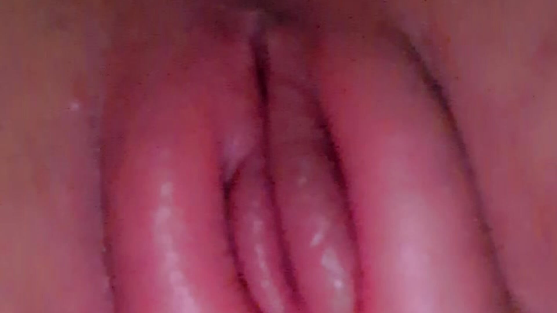 swollen pussy