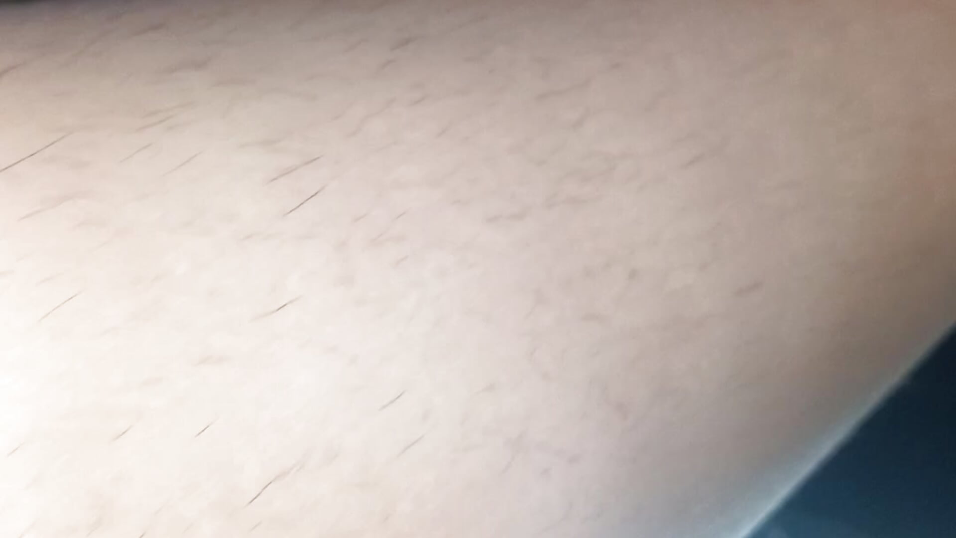 Mostro tutta la mia peluria del mio corpo p1