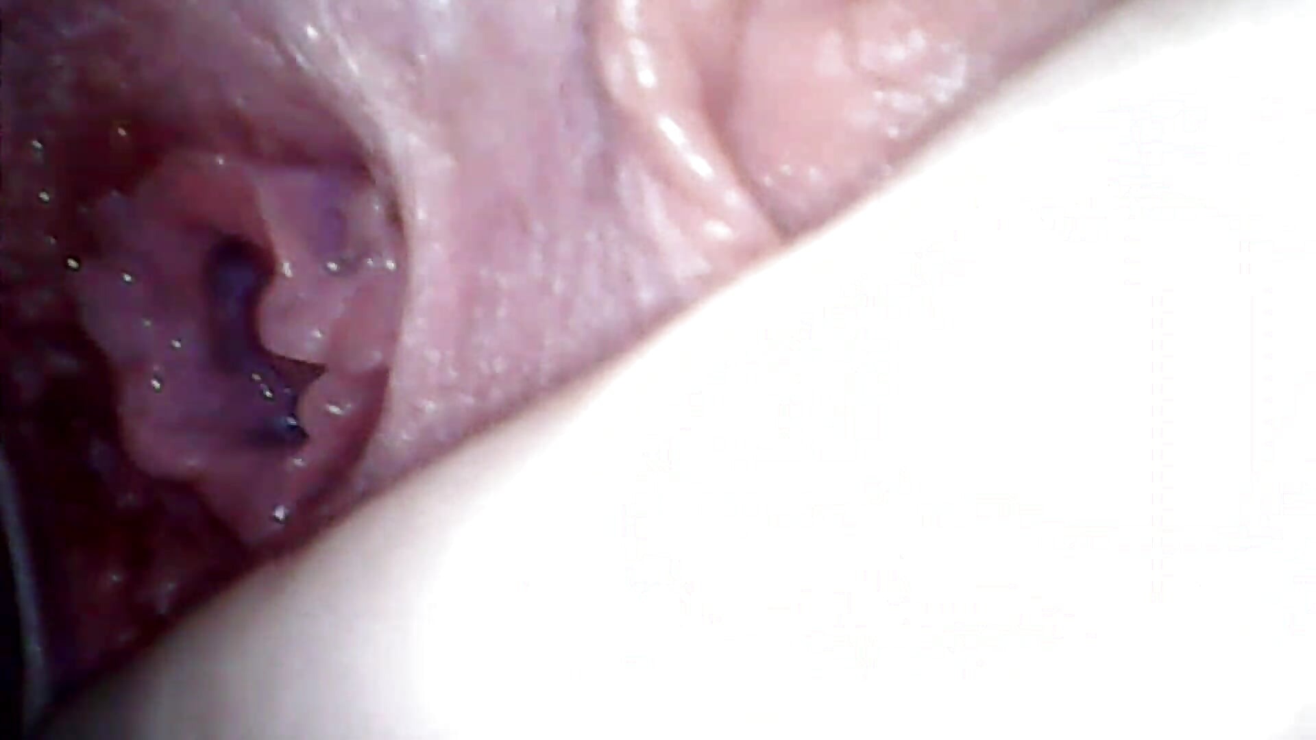 A very close view with a speculum