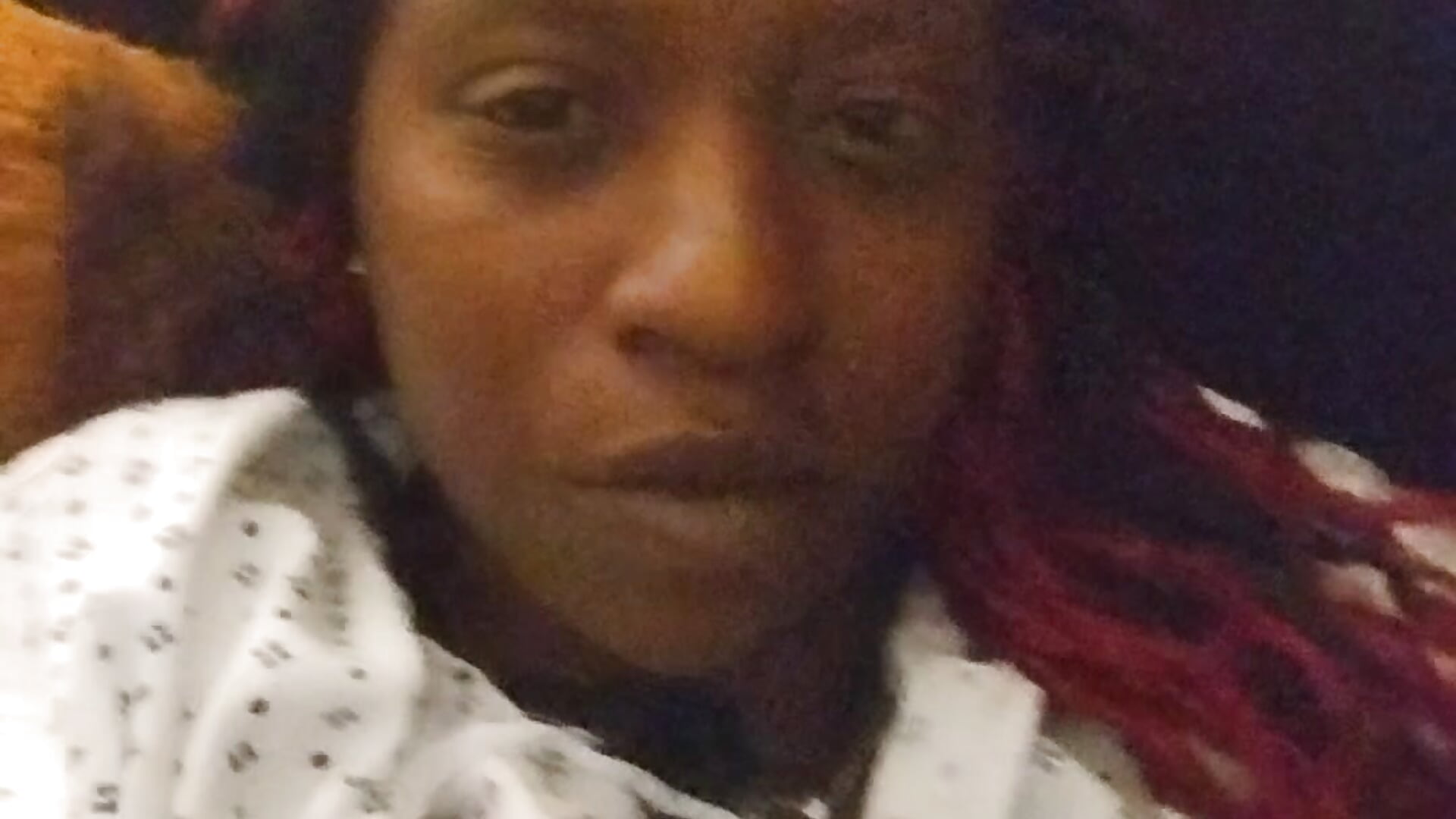 I broke my knee cap and my shin what shall I do - video oleh model kamera markquanna