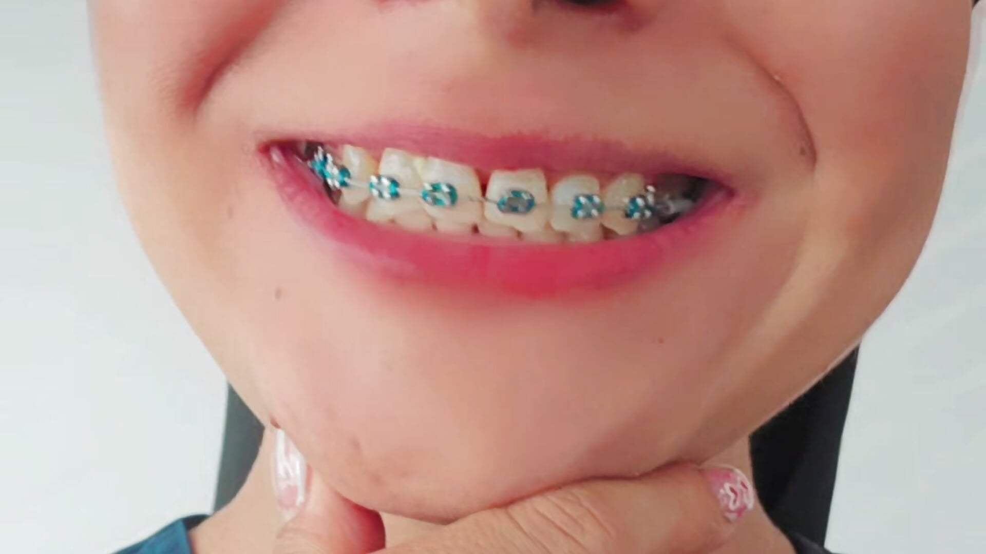 I share with you the procedure on my teeth. 🦷 - Vídeo de MistressSlut1