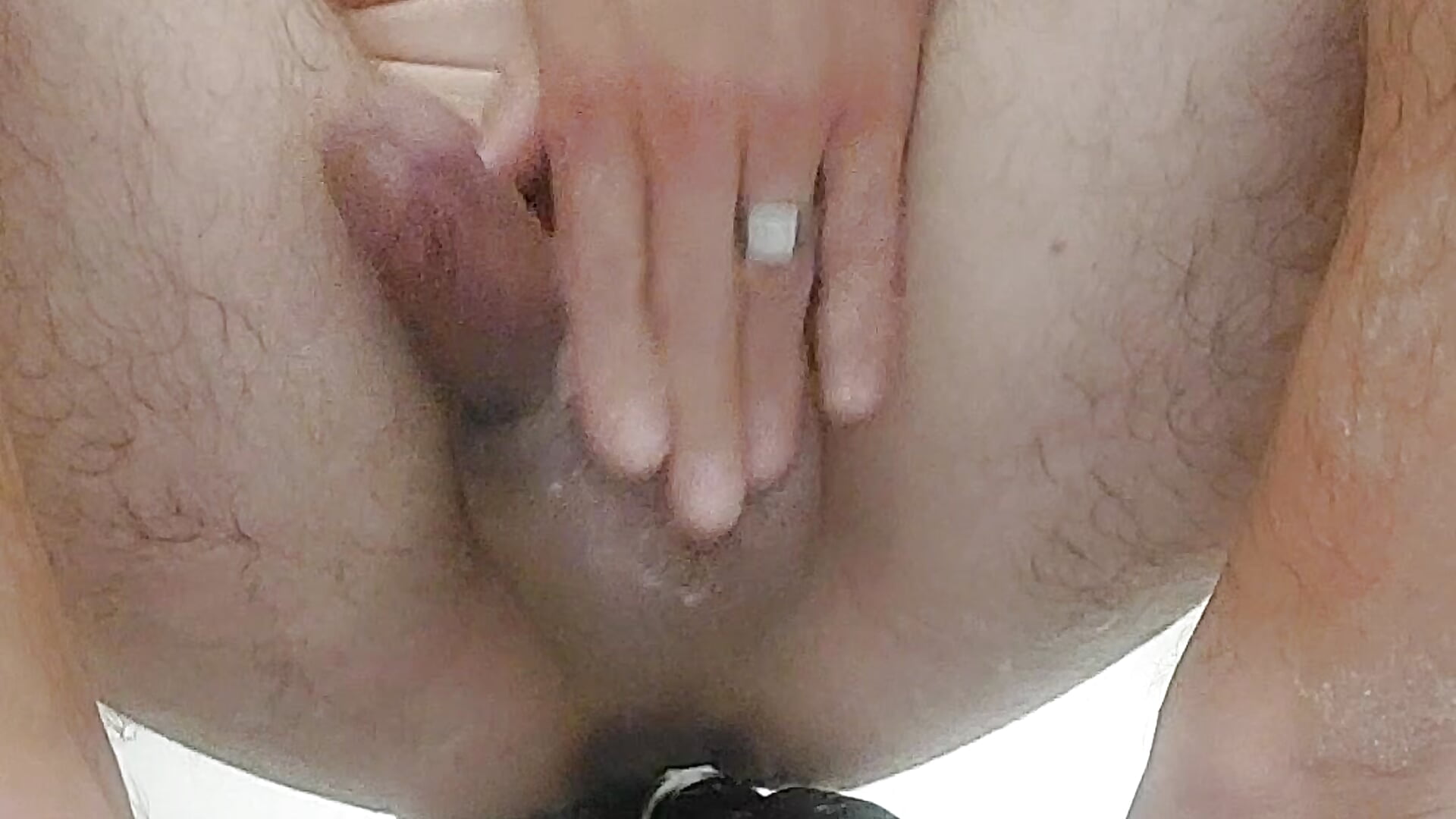 Plug anal